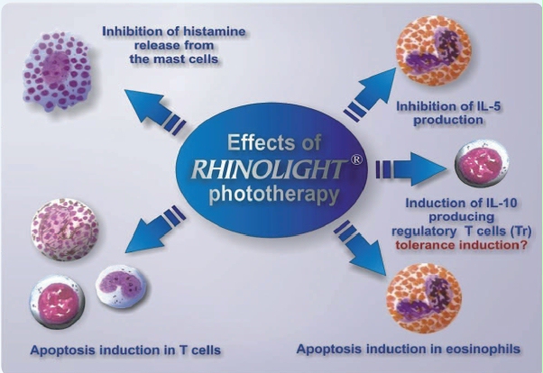 Fototerapia Intranasal con RhinoLight